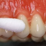 Coltene Vitality Control Endo-Frost - Image 2