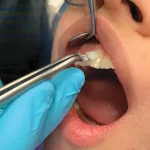 Coltene Vitality Control Endo-Frost - Image 6