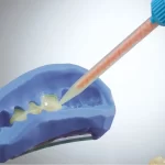 Dentsply Integrity Temporary Crown And Bridge Material - Image 6