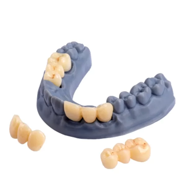 D-Tech 3D Accuprint Crown & Bridge Pro 3D Printing Resin - Image 2